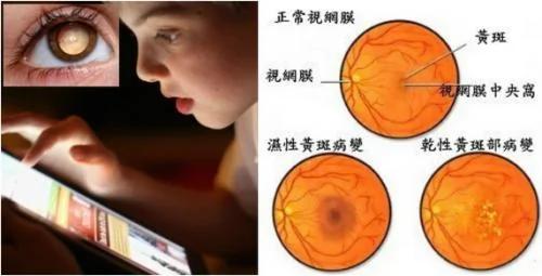 常看手机“视紫素”会严重受损!吃这些补回来!