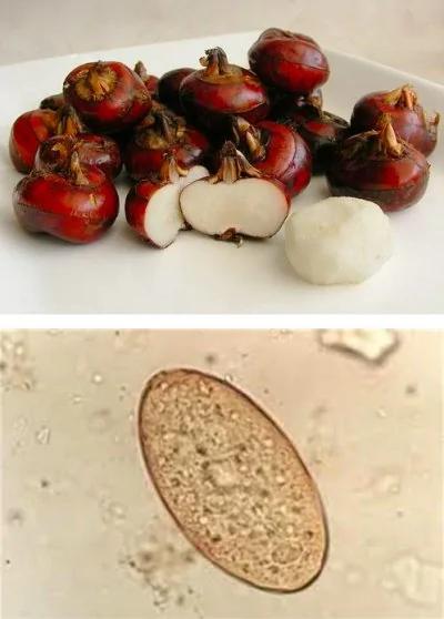小心!这6种食物错误的吃法,可能会让你吃下很多寄生虫!