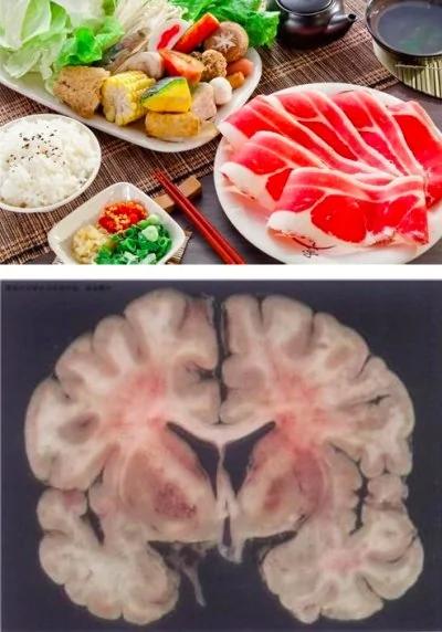 小心!这6种食物错误的吃法,可能会让你吃下很多寄生虫!