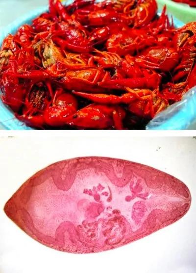 小心!这6种食物错误的吃法,可能会让你吃下很多寄生虫!