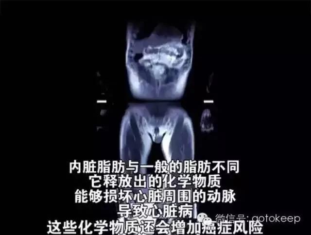热帖:关于减肥,你需要知道的10个惊人事实
