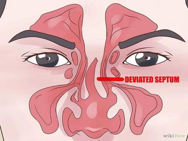 鼻塞时到底该吸进去还擤出来?没想到答案竟然是…太人震惊了!