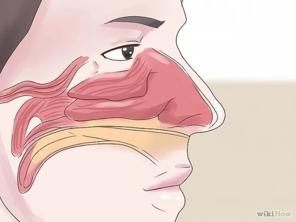 Get Rid of a Stuffy Nose Quickly Step18