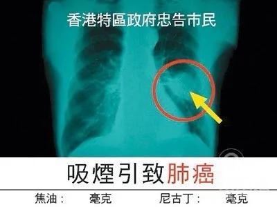 卷烟厂内部人员爆出惊天秘密 他们竟然都有「这种症状」