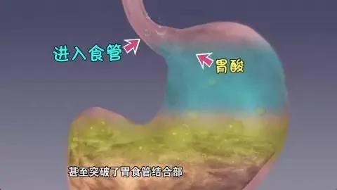 喝粥养胃?真相让你瞠目结舌...