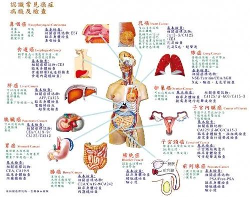 恍然大悟!原来癌症最青睐这些器官是因为……