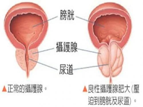 恍然大悟!原来癌症最青睐这些器官是因为……
