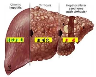 恍然大悟!原来癌症最青睐这些器官是因为……