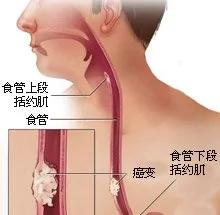 恍然大悟!原来癌症最青睐这些器官是因为……