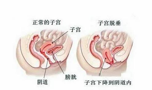 最伤害子宫的10种行为,许多女性后悔知道的太晚!