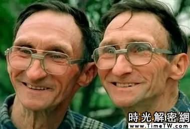 盘点不可思议双胞胎:超能力姐妹和镜子兄弟