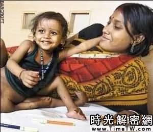 盘点不可思议双胞胎:超能力姐妹和镜子兄弟