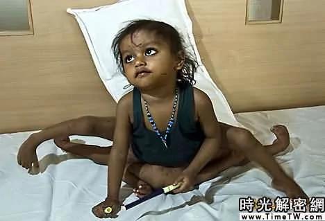 盘点不可思议双胞胎:超能力姐妹和镜子兄弟