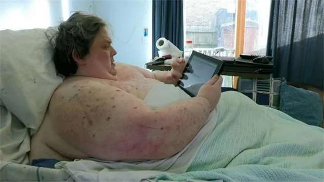 900斤男子接受全身扫描 X光照片惊呆众人