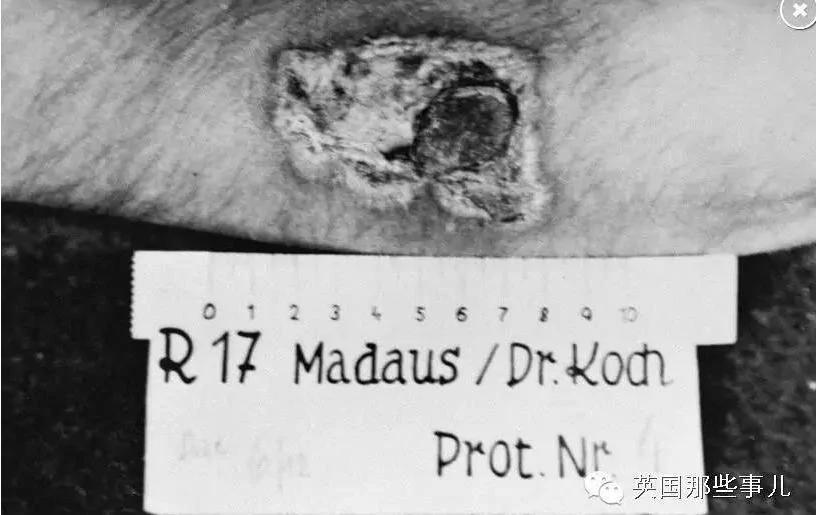 这群姑娘被掰断腿骨 砍掉四肢 只是他的脱罪实验