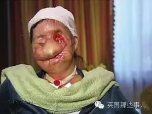 这个小男孩,逼他们杀死这只刚过17岁生日的猩猩…