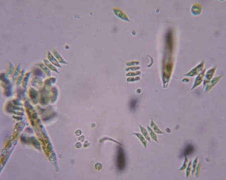 綠藻，顯微鏡下才能看清其結構。（維基百科）