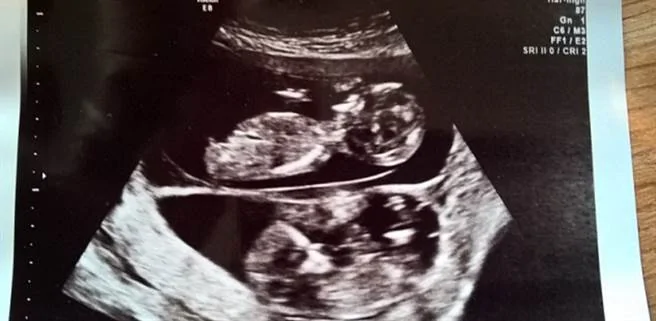 医生发现发现两个胎儿大小存在明显差异。(图/驱动之家)