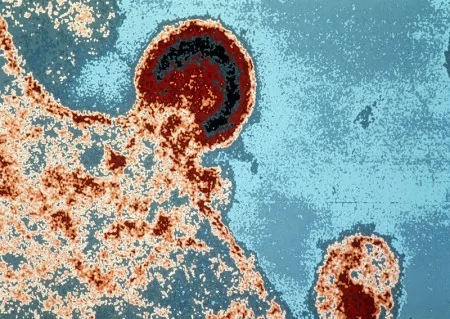 法国巴斯德研究所的显微镜照片显示了HIV病毒如何入侵人体淋巴细胞。（Getty Images)