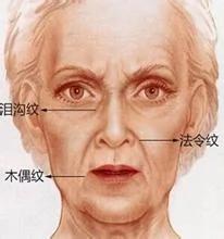 1种皱纹是最明显的衰老标志