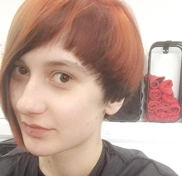 考试压力大 金发美女两个月头发掉光成秃头
