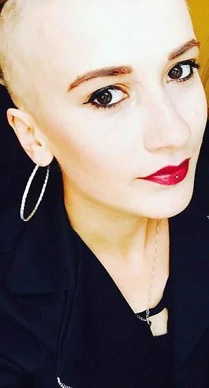 考试压力大 金发美女两个月头发掉光成秃头