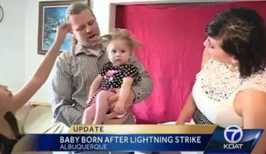 孕婦遭閃電擊，孩子出生後頭髮竟成這樣......