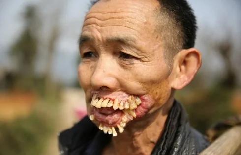 他…被一种动物舔过以后,就成了这个样子…恐怖