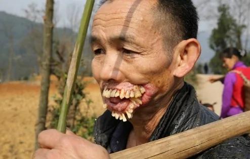 他…被一种动物舔过以后,就成了这个样子…恐怖