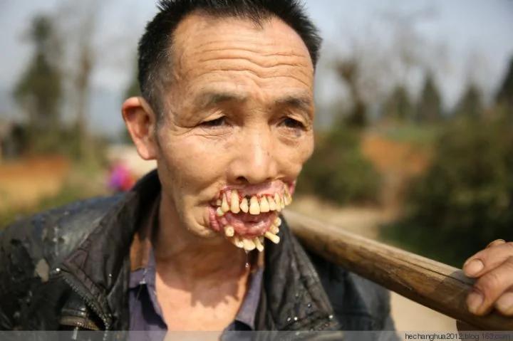 他…被一种动物舔过以后,就成了这个样子…恐怖