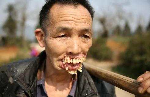 他…被一种动物舔过以后,就成了这个样子…恐怖