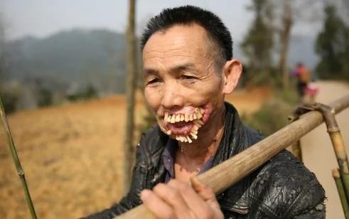 他…被一种动物舔过以后,就成了这个样子…恐怖
