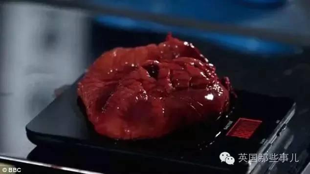 慎入:解剖胖子遗体拍成纪录片,看完不敢不减肥了!