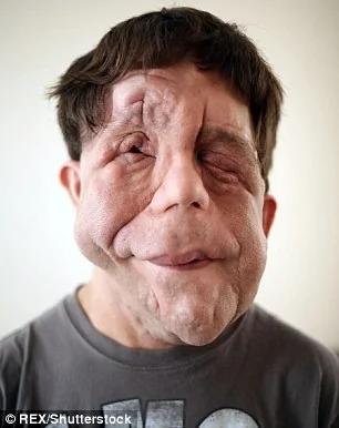 小时候一模一样的双胞胎长大后一个变帅哥,另一个却变成怪人!