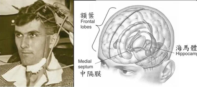 电影真人真事 15个离奇失去记忆案例