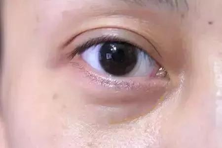 脾胃差的人难长寿, 4部位透露你脾胃差!