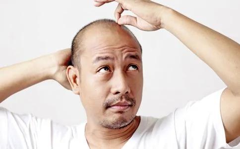 男人衰老三个典型标志 有什么方法预防衰老 图