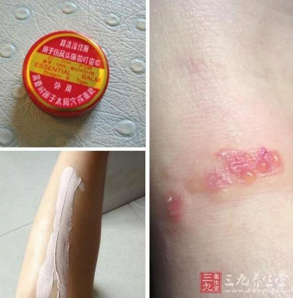 太全面!清凉油90%的用处你可能都不知道