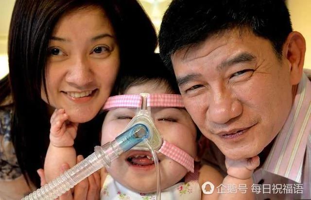 新加坡:17岁的她 被"困"在1岁婴儿身体里