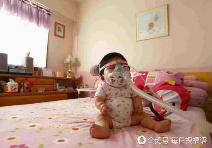 新加坡:17岁的她 被"困"在1岁婴儿身体里
