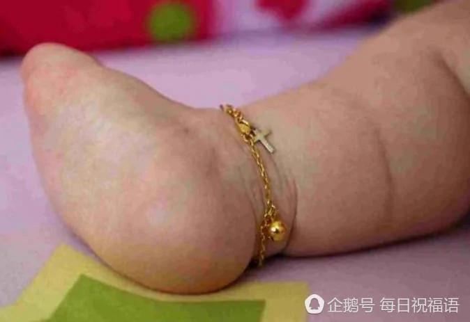 新加坡:17岁的她 被"困"在1岁婴儿身体里