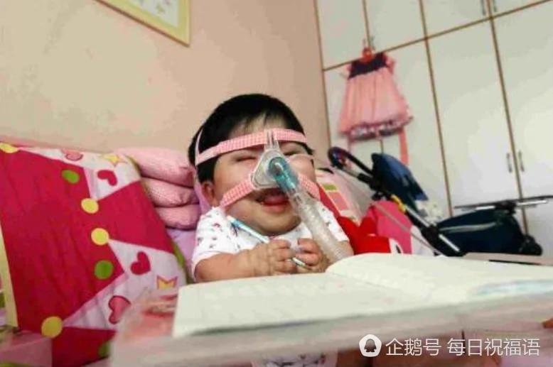新加坡:17岁的她 被"困"在1岁婴儿身体里