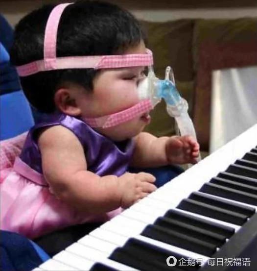 新加坡:17岁的她 被"困"在1岁婴儿身体里