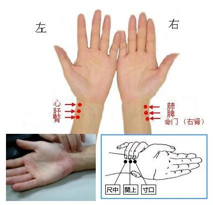 中医把脉知人健康福寿 根据是什么 多数人不知