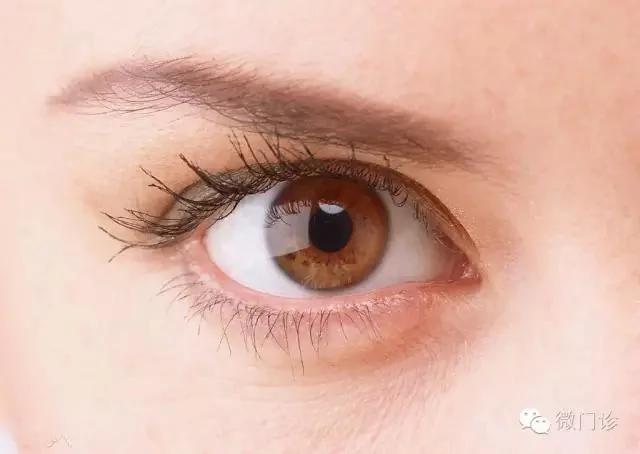 患上沙眼太痒了!告诉你一个迅速解决的办法