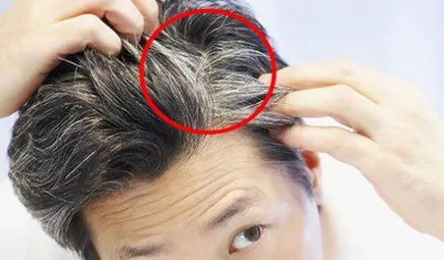 逆转白头发!6种天然“家庭疗法” 不用再花钱买染发剂!