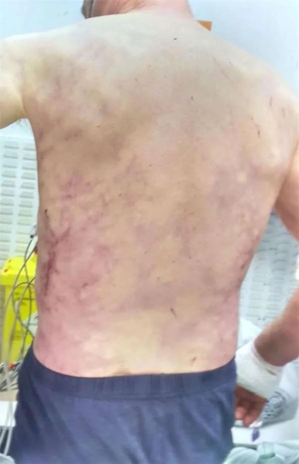 爱犬舍不得主人受伤而上前舔拭 结果这个温馨的举动竟危及饲主生命!