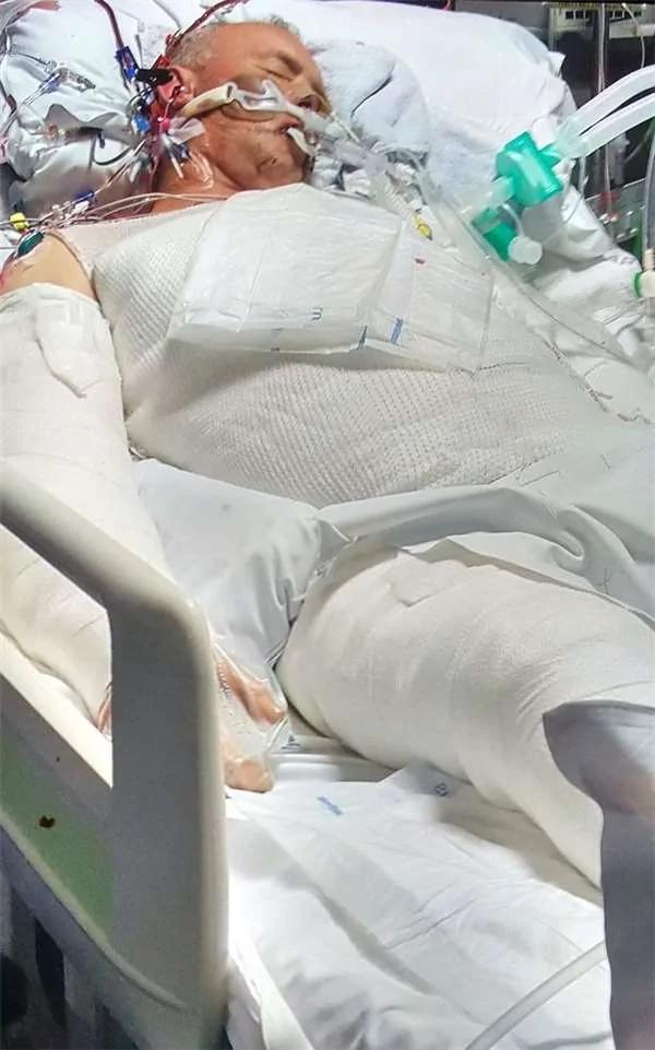 爱犬舍不得主人受伤而上前舔拭 结果这个温馨的举动竟危及饲主生命!