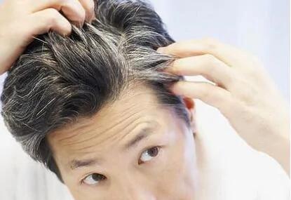 年纪轻轻就长白头发是什么原因?该怎么办?
