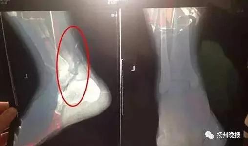 还敢做吗?抖腿会出大问题